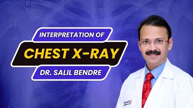 Interpretation of Chest X-ray