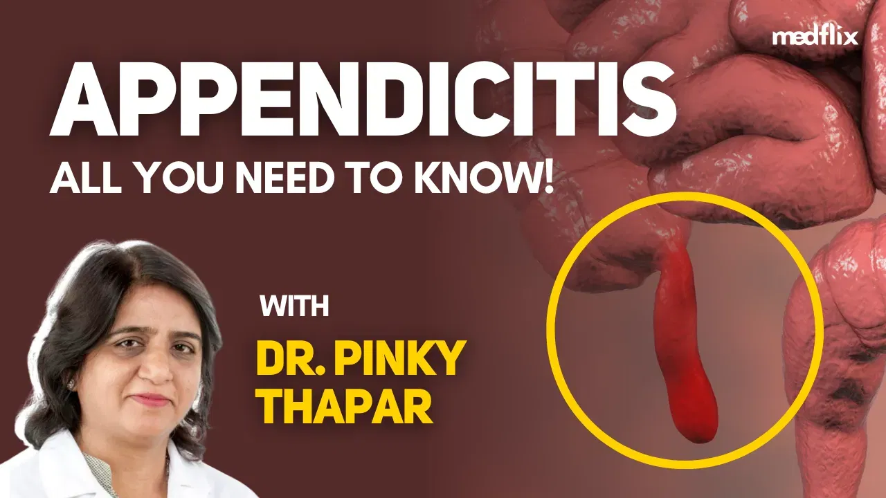 Management of Acute Appendicitis