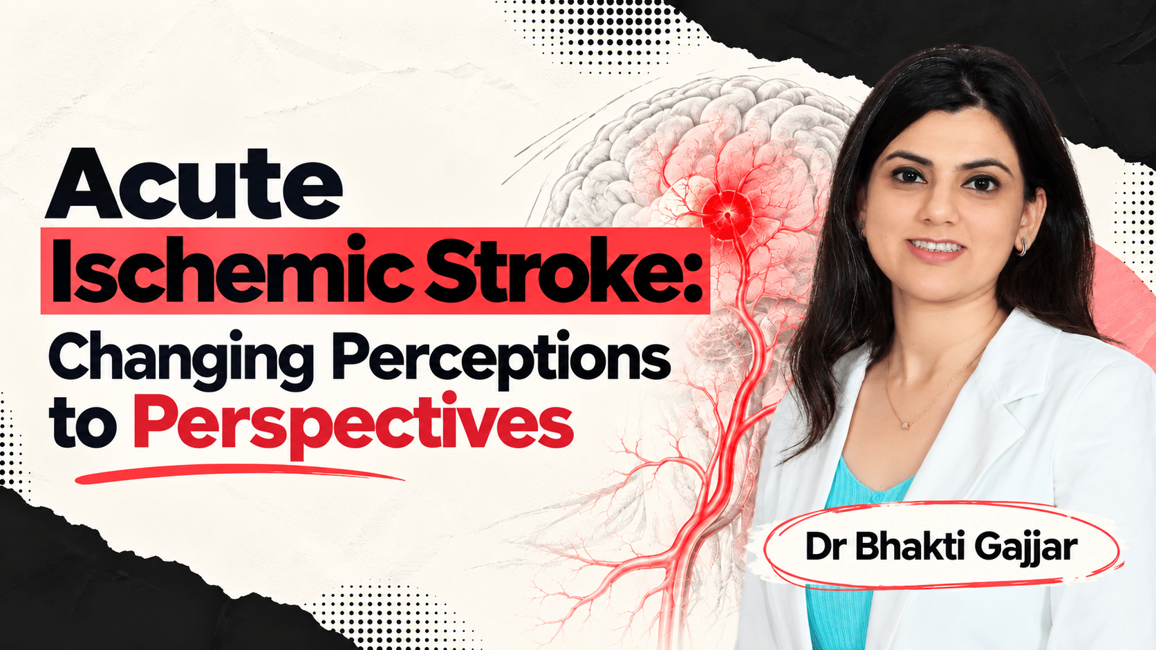 Acute Ischemic Stroke: Changing Perceptions to Perspectives