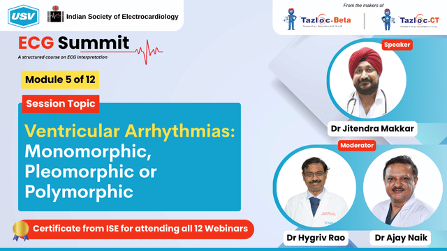 Ventricular Arrhythmias: Monomorphic, Pleomorphic or Polymorphic