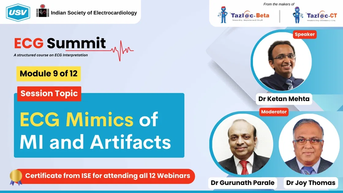 ECG Mimics of MI and Artifacts