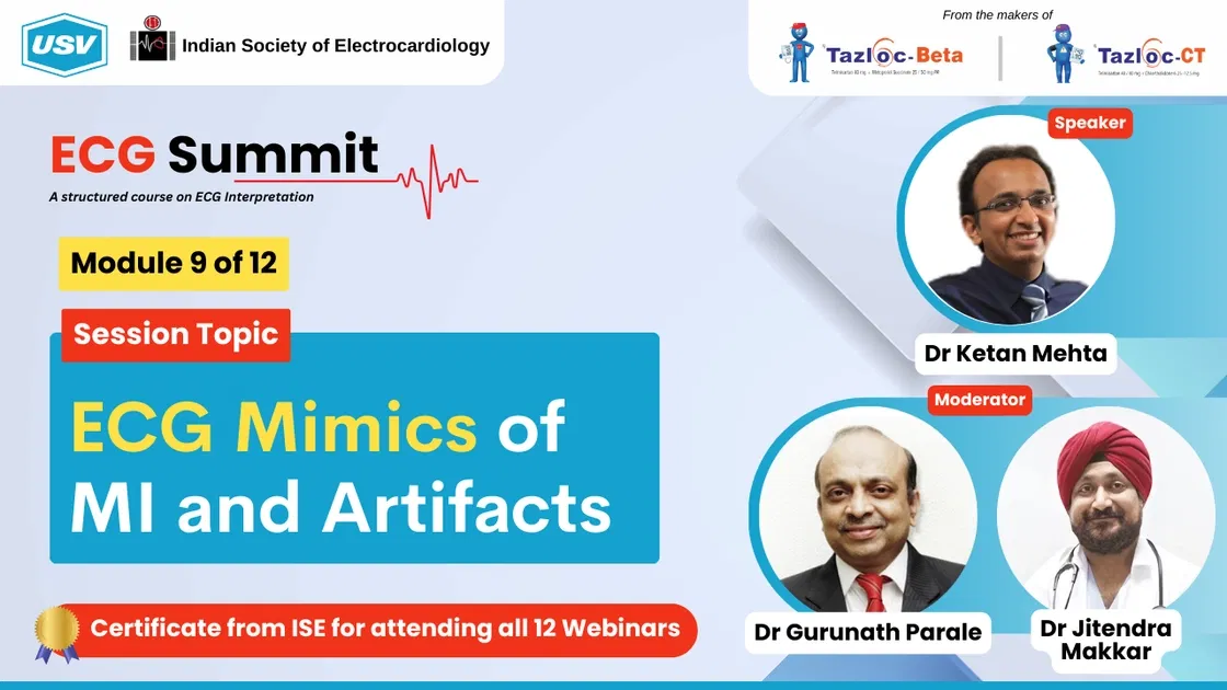 ECG Mimics of MI and Artifacts