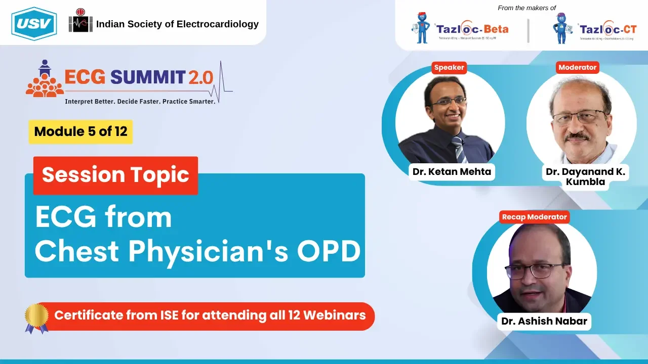 ECG from Chest Physician's OPD