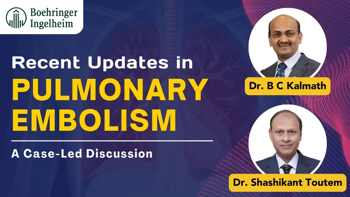 Recent Updates in Pulmonary Embolism: A Case-Led Discussion