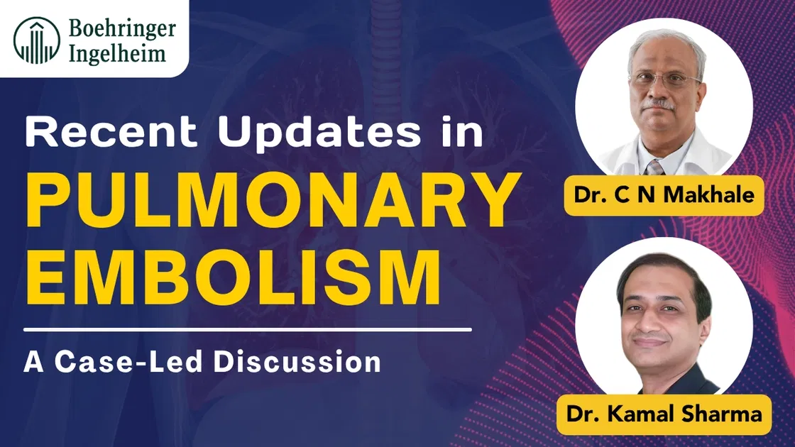 Recent Updates in Pulmonary Embolism: A Case-Led Discussion