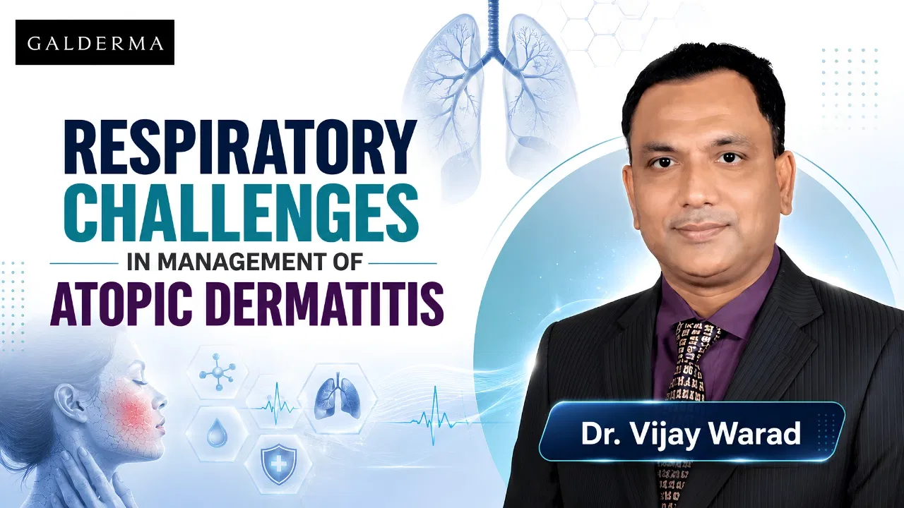 Respiratory Challenges in Management of Atopic Dermatitis